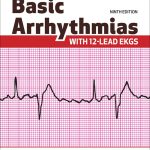 TESTBANK FOR Basic Arrhythmias with 12-lead EKGs, 9th edition Walraven - QUESTIONS ALL CHAPTERS PDF