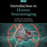 SOLUTION MANUAL FOR Introduction to Human Neuroimaging 2nd edition Hans Op de Beeck - ANSWERS ALL CHAPTERS PDF